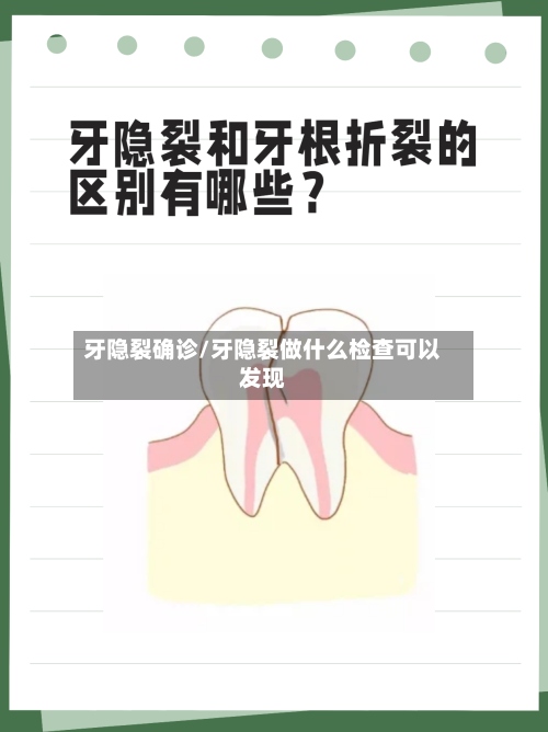 牙隐裂确诊/牙隐裂做什么检查可以发现-第2张图片