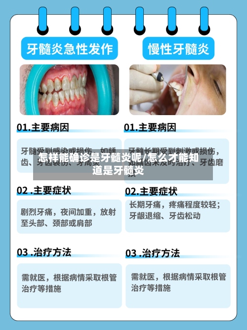 怎样能确诊是牙髓炎呢/怎么才能知道是牙髓炎-第2张图片