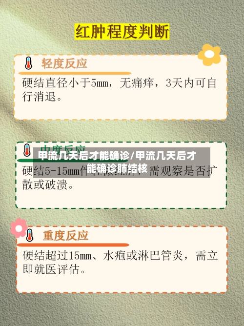 甲流几天后才能确诊/甲流几天后才能确诊肺结核-第3张图片