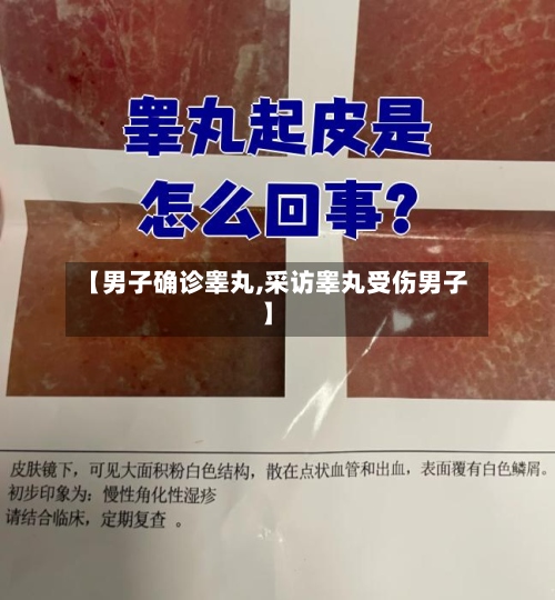 【男子确诊睾丸,采访睾丸受伤男子】