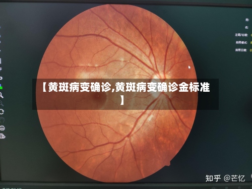【黄斑病变确诊,黄斑病变确诊金标准】-第2张图片