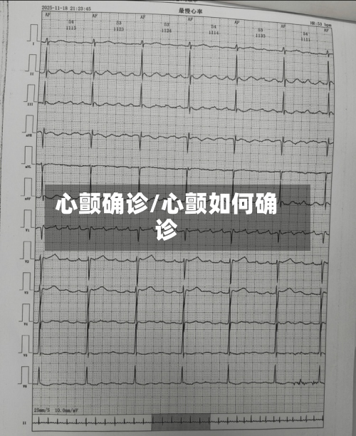 心颤确诊/心颤如何确诊