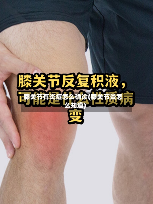 膝关节有炎症怎么确诊(膝关节炎怎么知道)-第2张图片