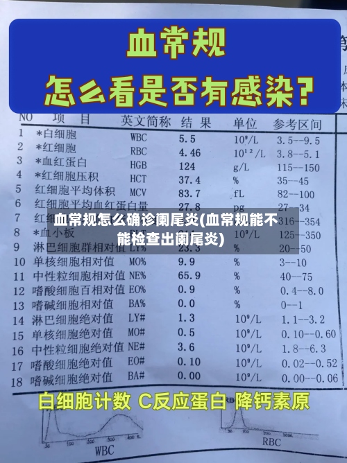 血常规怎么确诊阑尾炎(血常规能不能检查出阑尾炎)