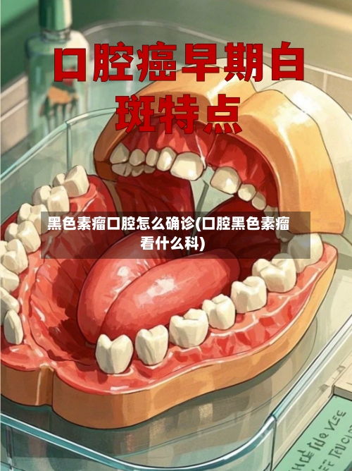 黑色素瘤口腔怎么确诊(口腔黑色素瘤看什么科)-第3张图片