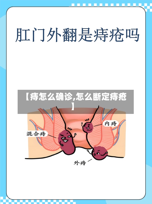 【痔怎么确诊,怎么断定痔疮】-第2张图片