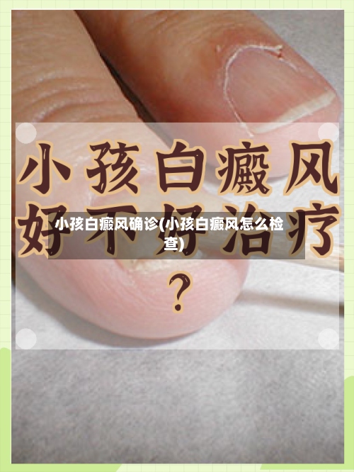 小孩白癜风确诊(小孩白癜风怎么检查)-第2张图片
