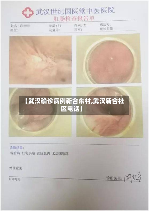 【武汉确诊病例新合东村,武汉新合社区电话】