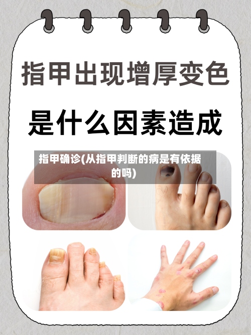 指甲确诊(从指甲判断的病是有依据的吗)-第2张图片