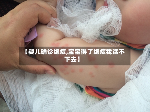 【婴儿确诊绝症,宝宝得了绝症我活不下去】