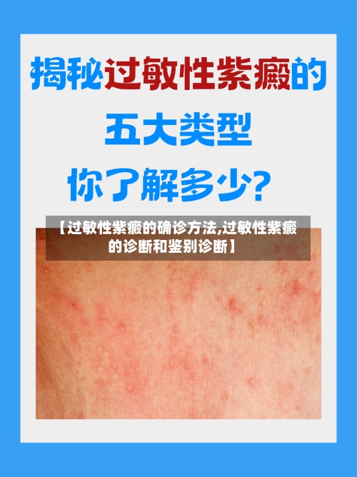 【过敏性紫癜的确诊方法,过敏性紫癜的诊断和鉴别诊断】-第3张图片