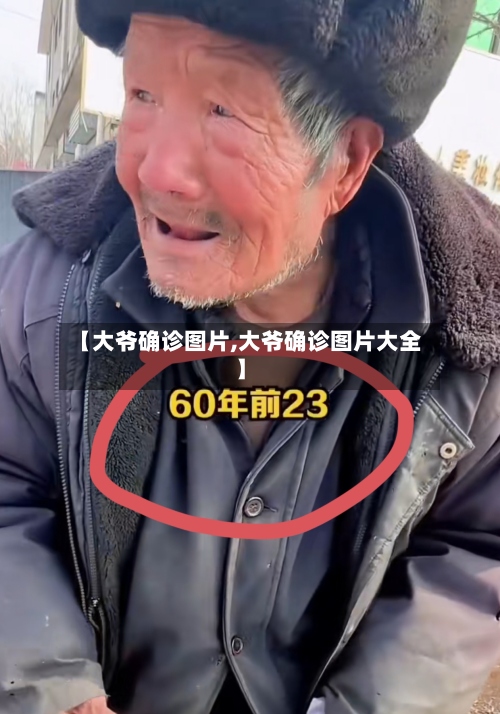 【大爷确诊图片,大爷确诊图片大全】