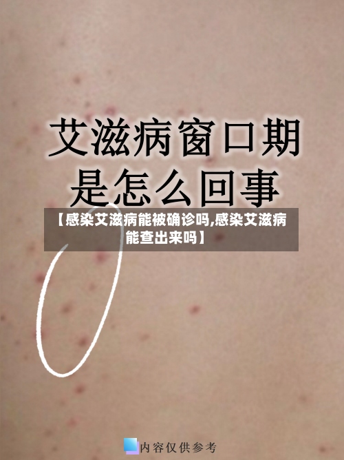 【感染艾滋病能被确诊吗,感染艾滋病能查出来吗】-第3张图片