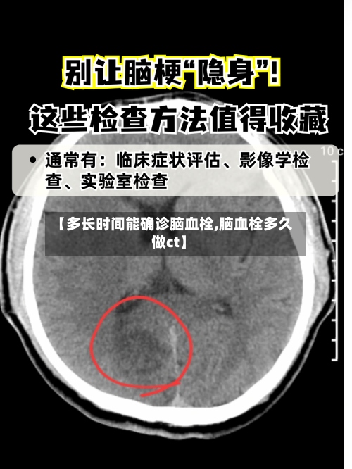 【多长时间能确诊脑血栓,脑血栓多久做ct】-第2张图片