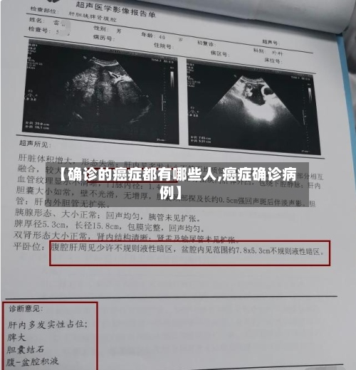 【确诊的癌症都有哪些人,癌症确诊病例】-第2张图片