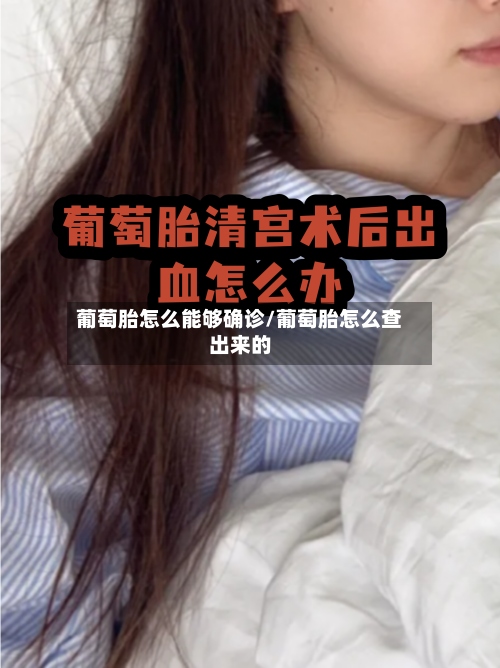 葡萄胎怎么能够确诊/葡萄胎怎么查出来的-第3张图片