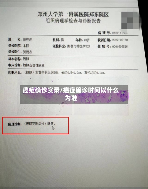 癌症确诊实录/癌症确诊时间以什么为准