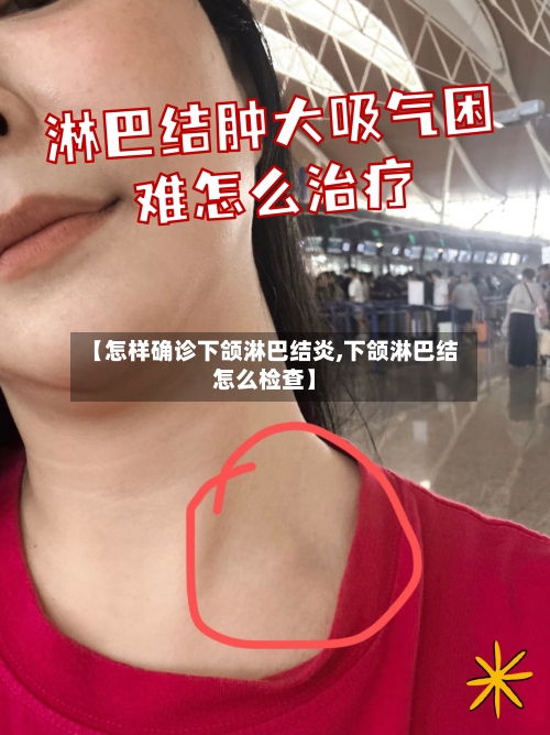 【怎样确诊下颌淋巴结炎,下颌淋巴结怎么检查】