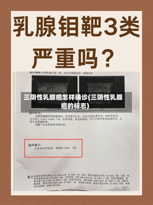 三阴性乳腺癌怎样确诊(三阴性乳腺癌的标志)-第3张图片