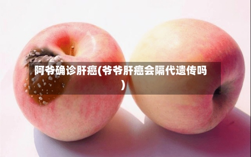 阿爷确诊肝癌(爷爷肝癌会隔代遗传吗)