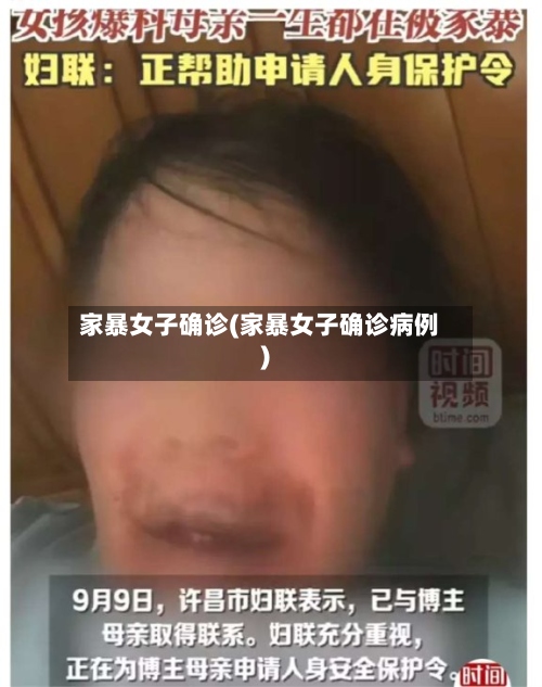 家暴女子确诊(家暴女子确诊病例)-第3张图片