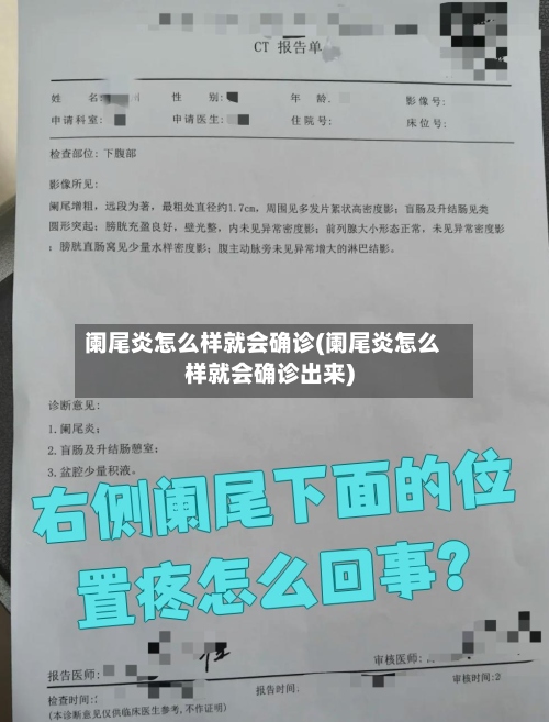 阑尾炎怎么样就会确诊(阑尾炎怎么样就会确诊出来)