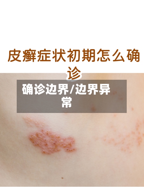 确诊边界/边界异常