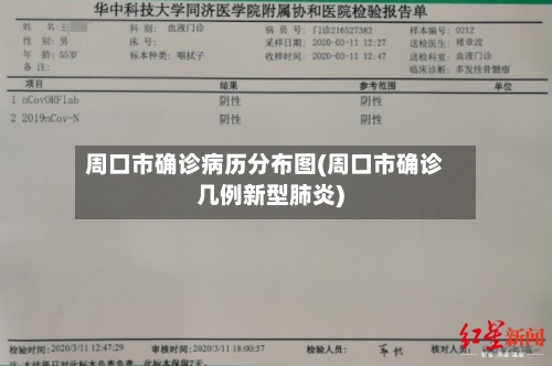 周口市确诊病历分布图(周口市确诊几例新型肺炎)