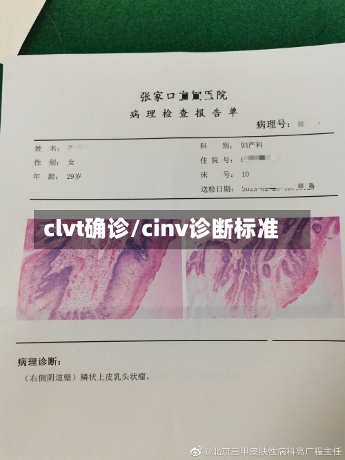 clvt确诊/cinv诊断标准-第2张图片