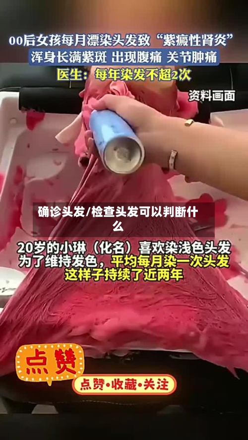 确诊头发/检查头发可以判断什么-第2张图片