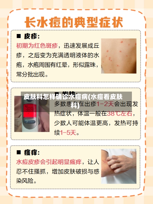 皮肤科怎样确诊水痘病(水痘看皮肤科)-第2张图片
