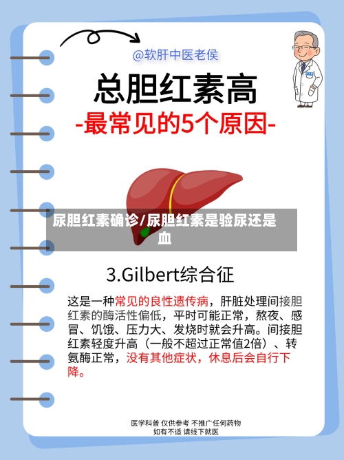 尿胆红素确诊/尿胆红素是验尿还是血