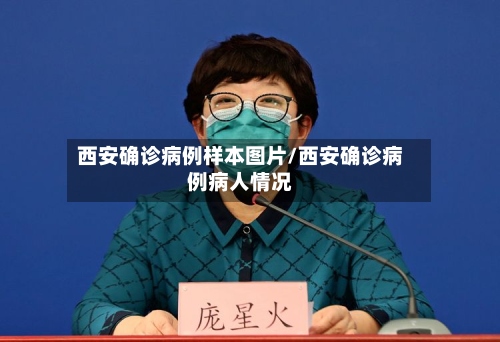西安确诊病例样本图片/西安确诊病例病人情况