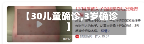【30儿童确诊,3岁确诊】