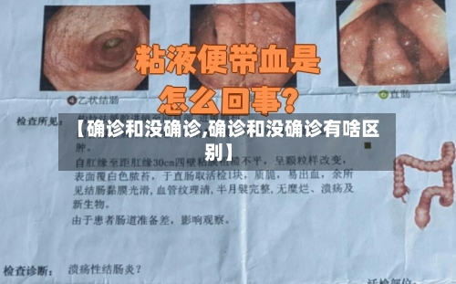 【确诊和没确诊,确诊和没确诊有啥区别】
