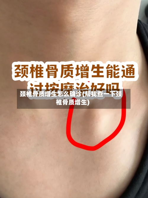 颈椎骨质增生怎么确诊(帮我查一下颈椎骨质增生)-第3张图片