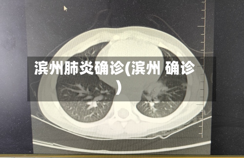 滨州肺炎确诊(滨州 确诊)