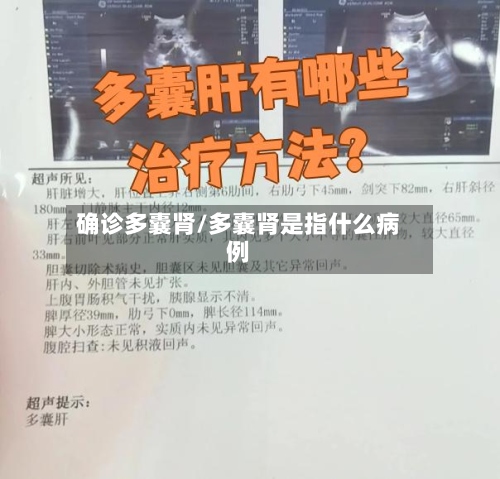 确诊多囊肾/多囊肾是指什么病例-第2张图片