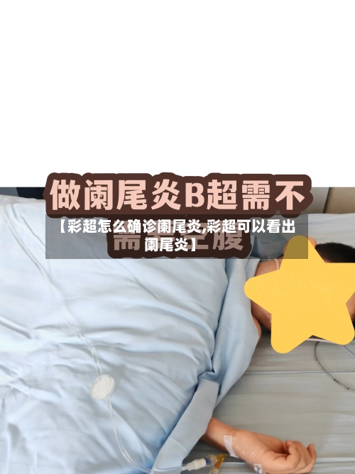 【彩超怎么确诊阑尾炎,彩超可以看出阑尾炎】
