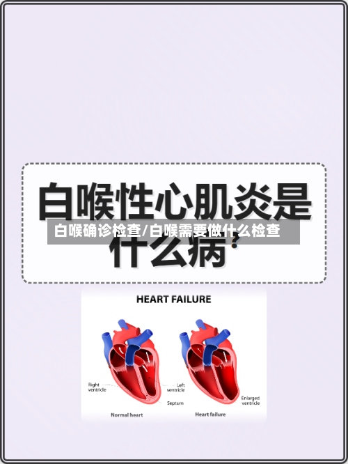 白喉确诊检查/白喉需要做什么检查-第2张图片