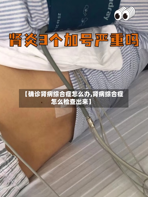 【确诊肾病综合症怎么办,肾病综合症怎么检查出来】-第2张图片