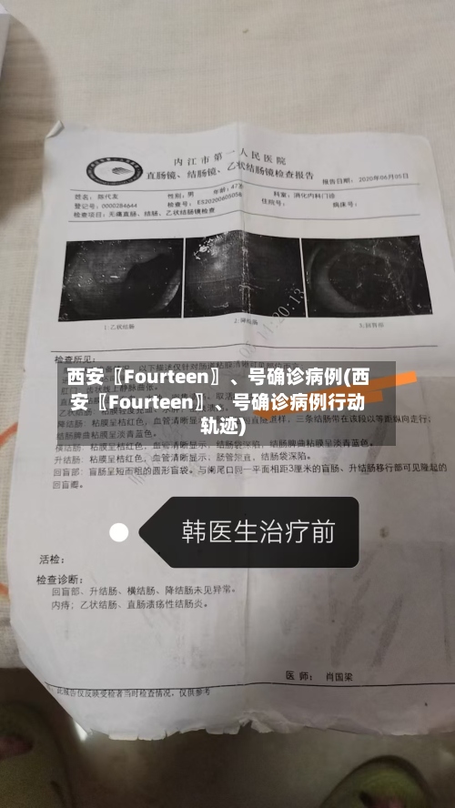 西安〖Fourteen〗	、号确诊病例(西安〖Fourteen〗、号确诊病例行动轨迹)-第3张图片
