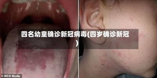 四名幼童确诊新冠病毒(四岁确诊新冠)-第2张图片