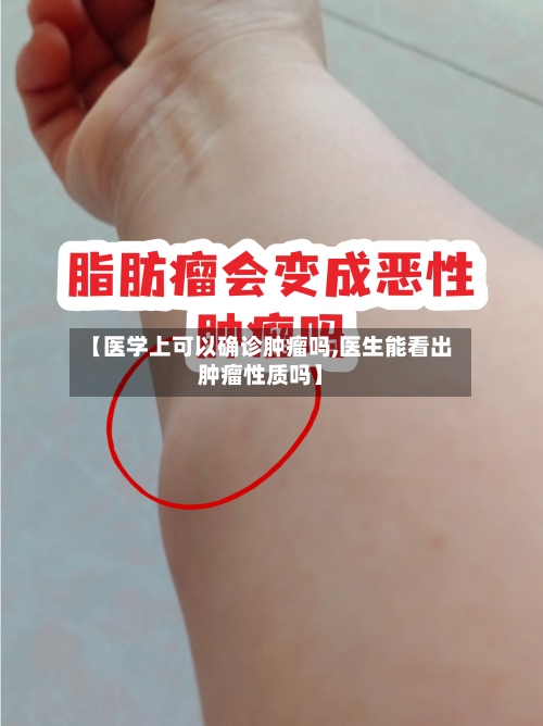 【医学上可以确诊肿瘤吗,医生能看出肿瘤性质吗】