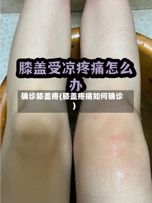 确诊膝盖疼(膝盖疼痛如何确诊)