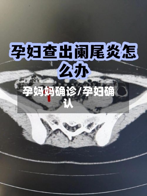 孕妈妈确诊/孕妇确认
