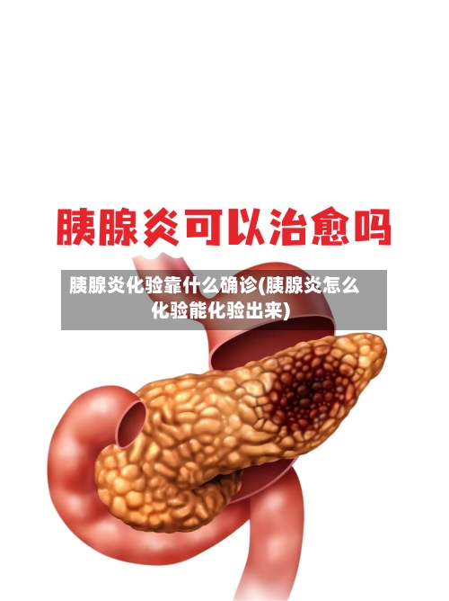 胰腺炎化验靠什么确诊(胰腺炎怎么化验能化验出来)-第3张图片
