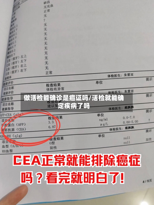 做活检能确诊是癌证吗/活检就能确定疾病了吗-第2张图片