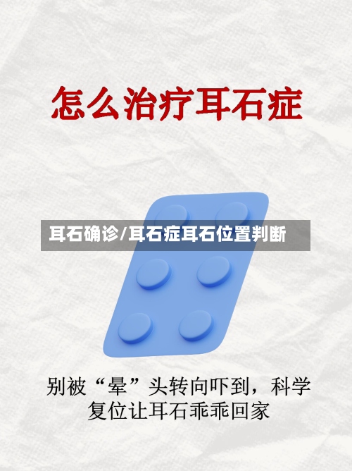 耳石确诊/耳石症耳石位置判断