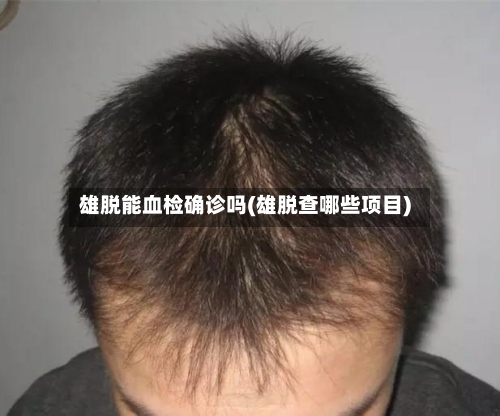 雄脱能血检确诊吗(雄脱查哪些项目)-第3张图片